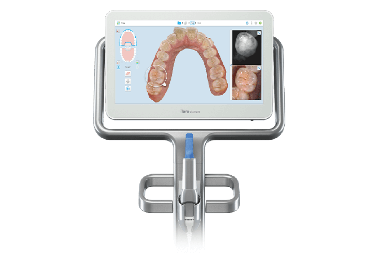 A dental scanning device with a touchscreen showing a 3D dental model and images of teeth.