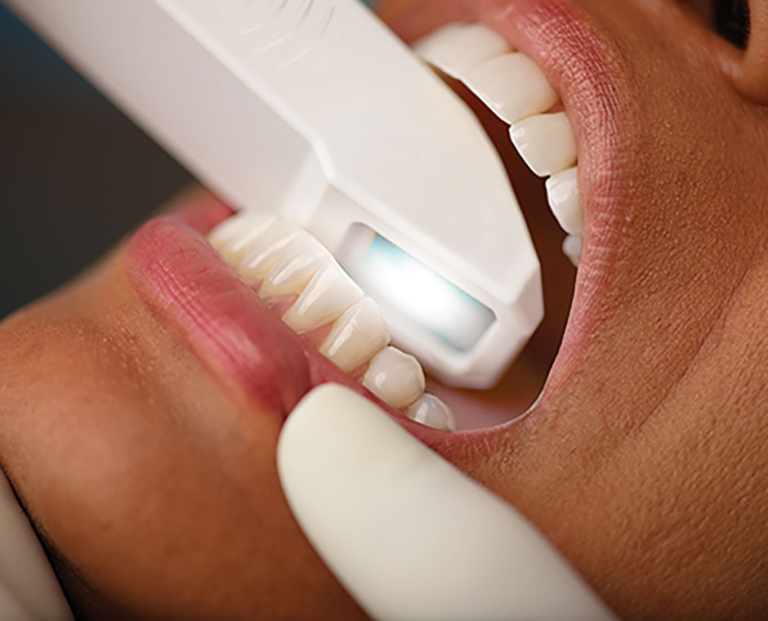 A close-up of a person's mouth with a dental tool examining their teeth, highlighting oral health checks.